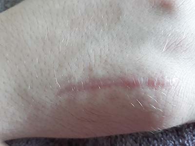 Before
